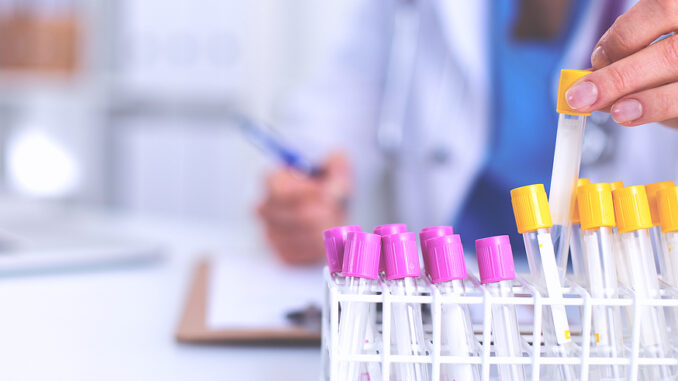 Blood Gas Analyzer Changeover